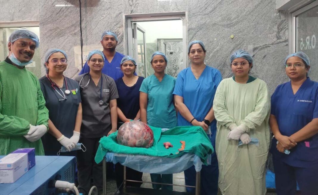 रायपुर : सिम्स में जटिल सर्जरी, 65 वर्षीय महिला के पेट से निकाला गया 10 किलो से अधिक वजन का ट्यूमर