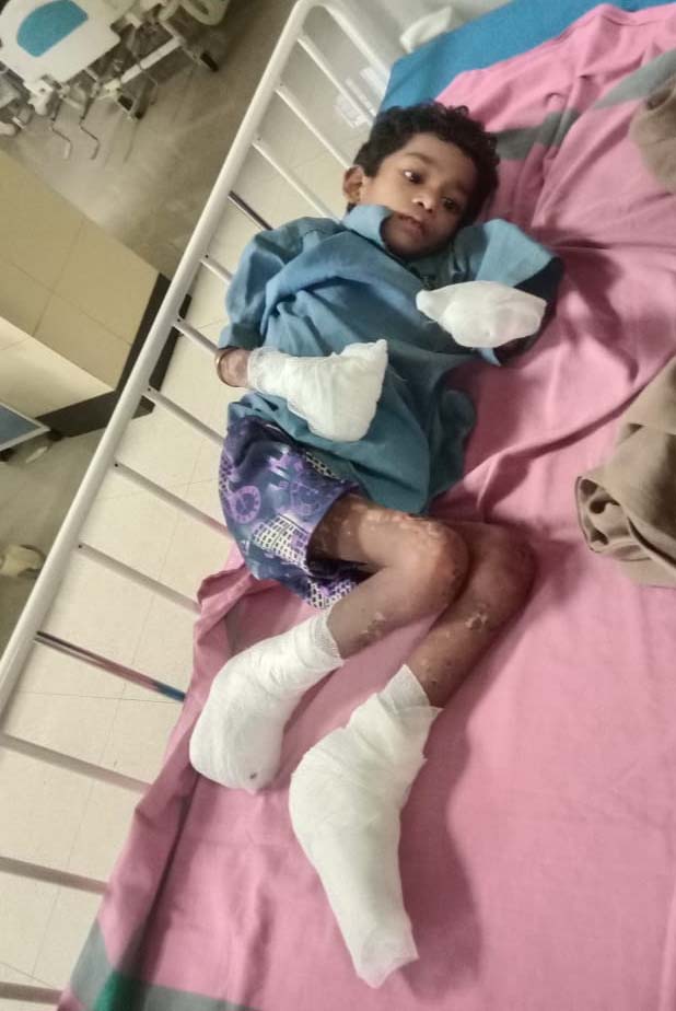 रायपुर : अबूझमाड़ के जंगल से निकालकर बीमार बचपन को जिला प्रशासन ने नई जिंदगी के लिए पहुंचाया रायपुर