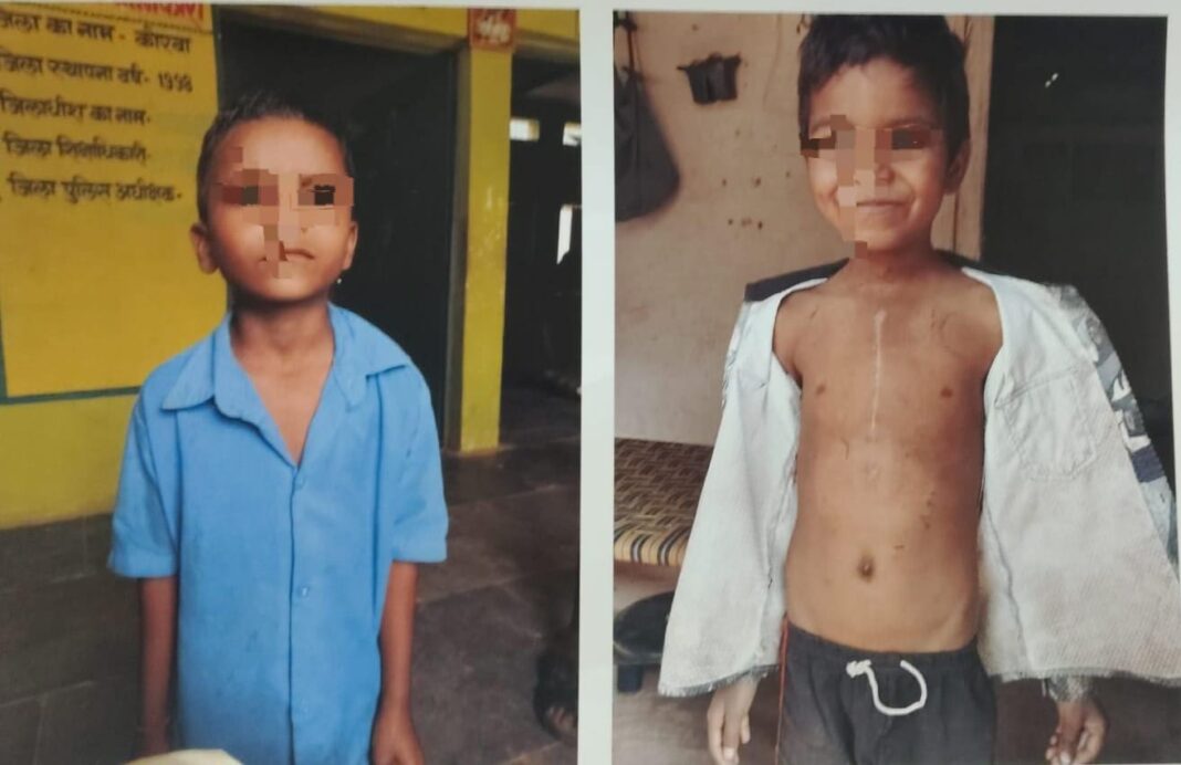 KORBA : चिरायु योजना बनी संजीवनी, लक्ष्मीनारायण को मिला नया जीवन