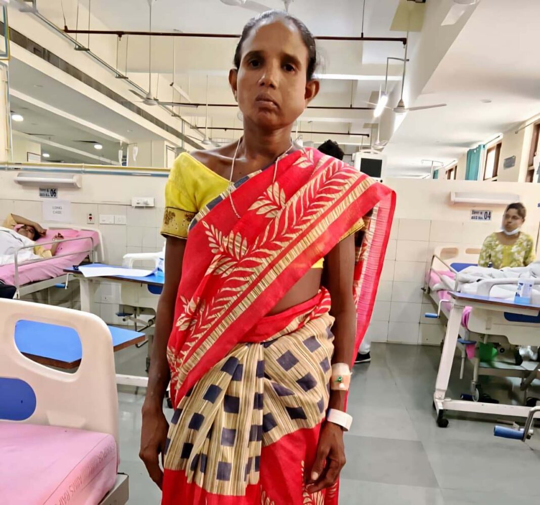 रायपुर : संजीवनी बना मेगा सुपर स्पेशलिटी हेल्थ कैंप