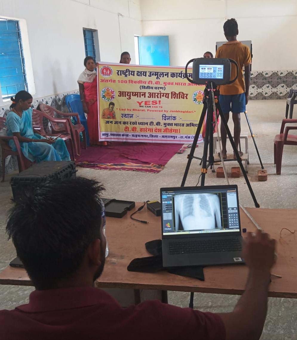 रायपुर : अत्याधुनिक हैंड हेल्ड एक्स-रे तकनीक से तेज हुई टीबी मरीजों की पहचान