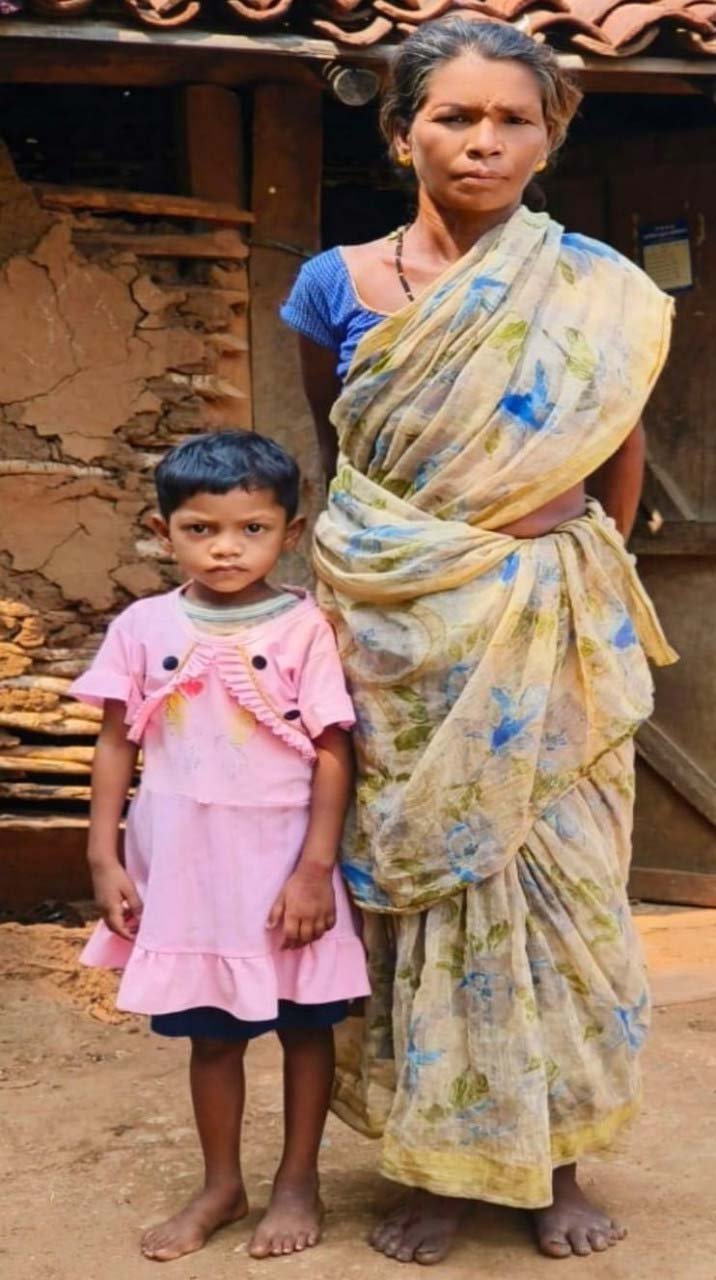 रायपुर : धड़क उठा मासूमों का दिल- ‘प्रोजेक्ट धड़कन’ ने नारायणपुर के तीन नौनिहालों को दिया नया जीवन