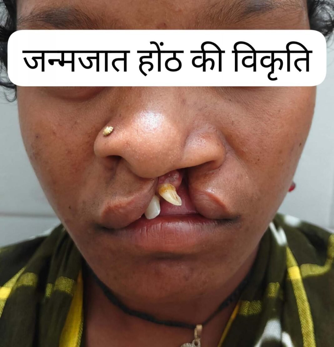 रायपुर : सफल सर्जरी से भीमे हेमला के चेहरे पर लौटी मुस्कान