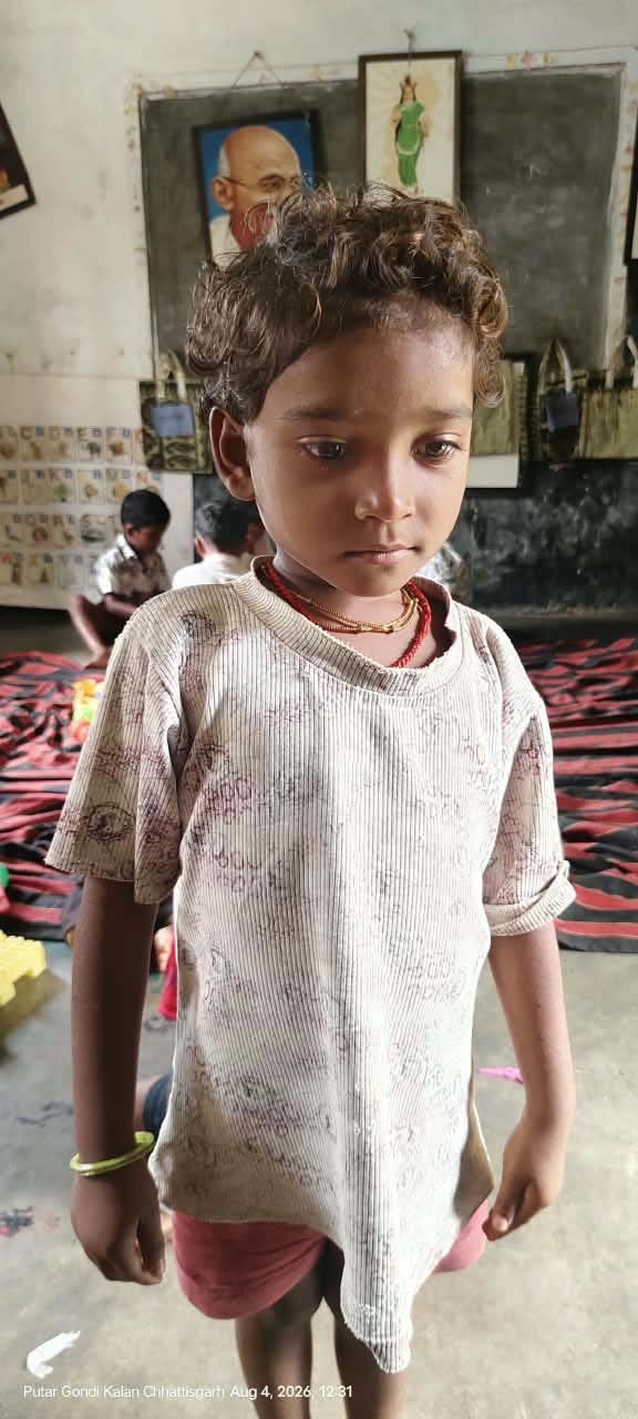 रायपुर : सेवा संकल्प अभियान : सेवा संकल्प से कुपोषण पर जीत, 16 सप्ताह में मिनाक्षी ने पाई सामान्य पोषण स्थिति